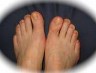 Foot Health Milton Keynes Foot Health in Milton Keynes